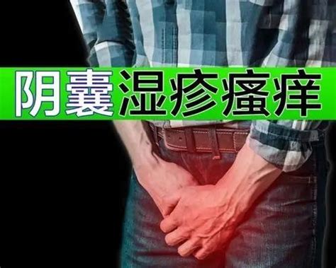 陰部生倉|陰囊炎：症狀、病因及如何治療